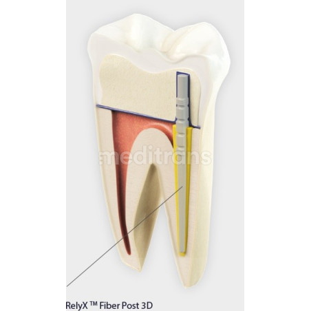 RelyX Fiber Post 3D 10 sztuk