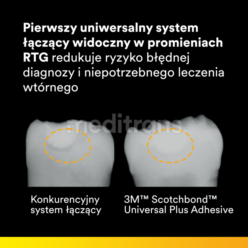 Scotchbond Universal Plus uzupełnienie 5ml