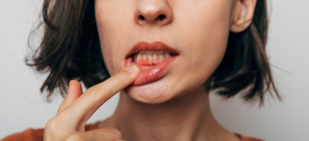Interdyscyplinarne leczenie wad zgryzu – jak współpracują ortodonta i periodontolog?